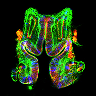 Male Drosophila genital imaginal disc during the pupal stage showing mesenchyme-to-epithelial transitions.